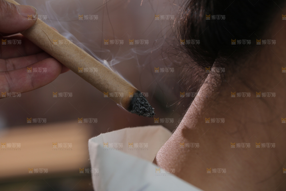 艾灸