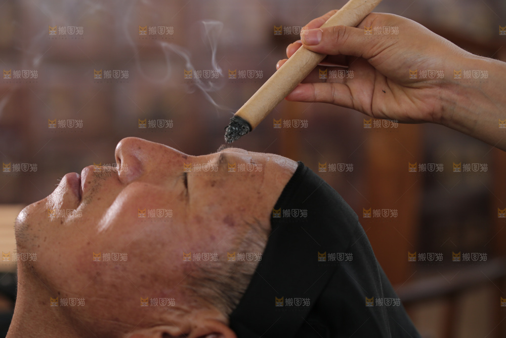艾灸