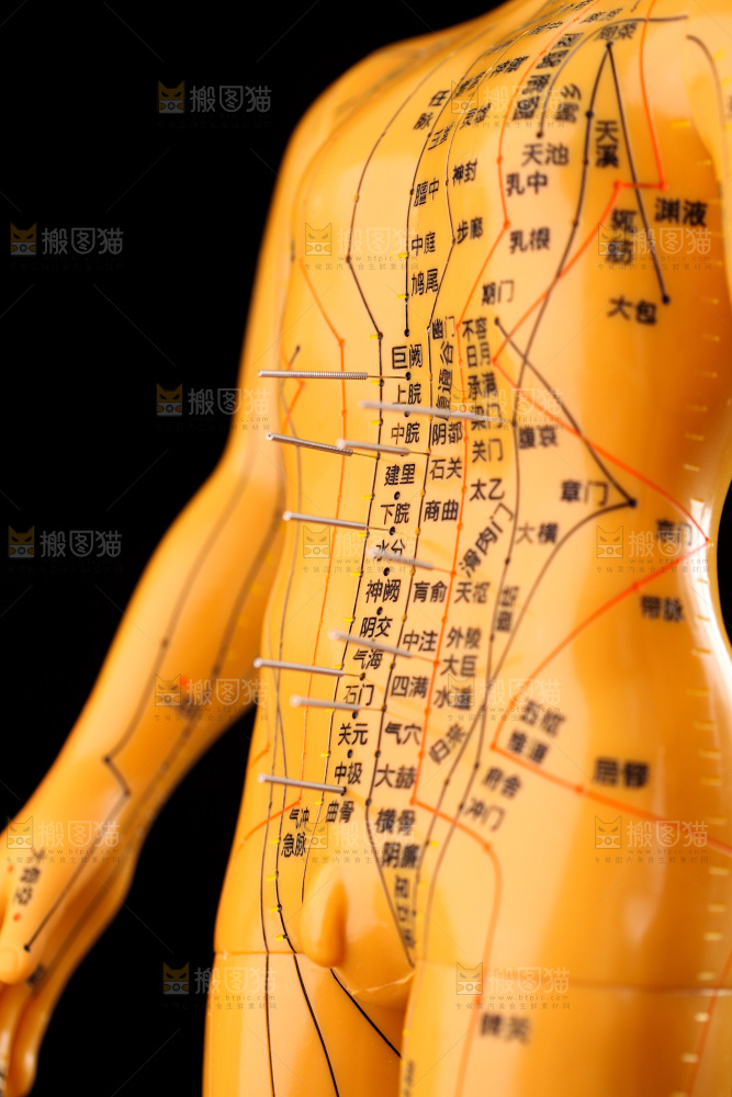 针灸