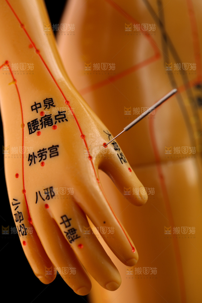 针灸