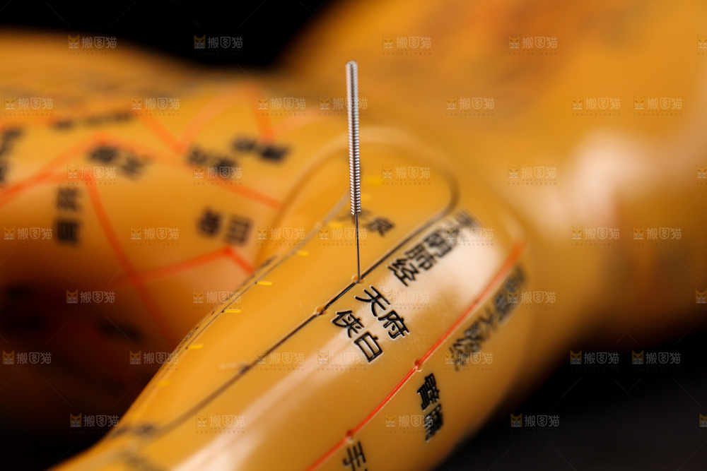 针灸
