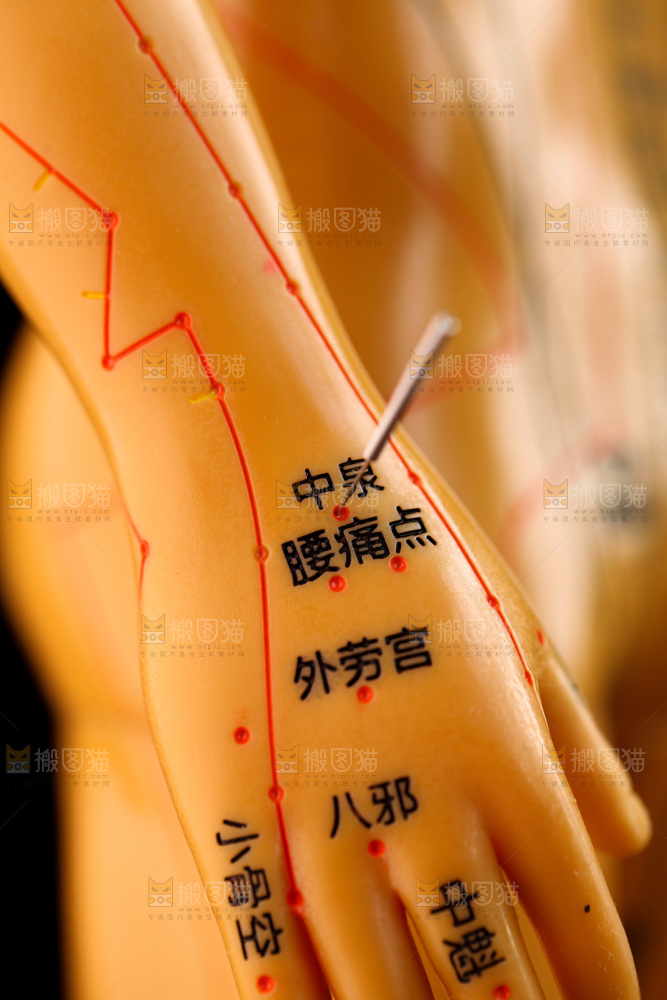 针灸