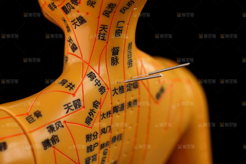 针灸