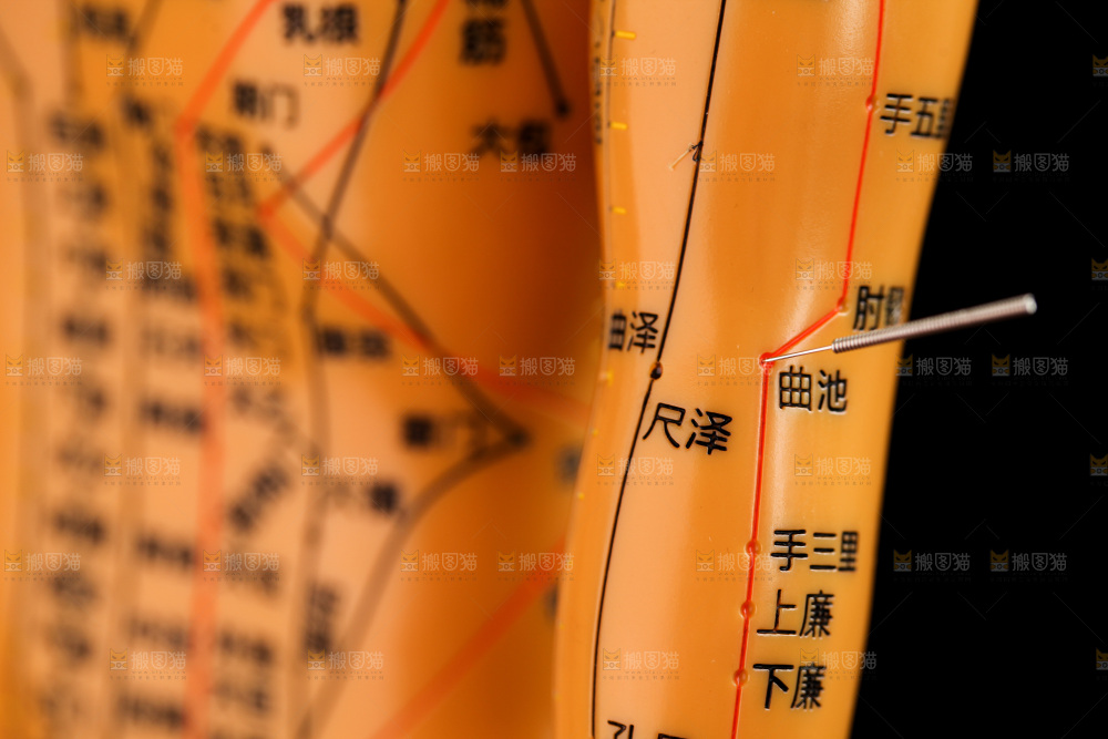 针灸