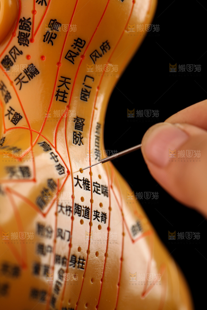 针灸
