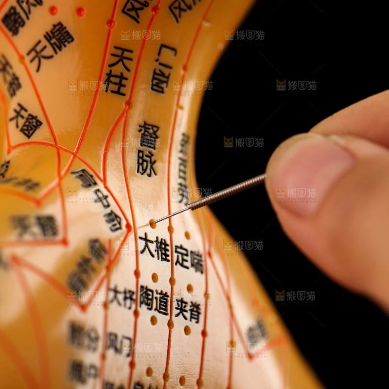 针灸