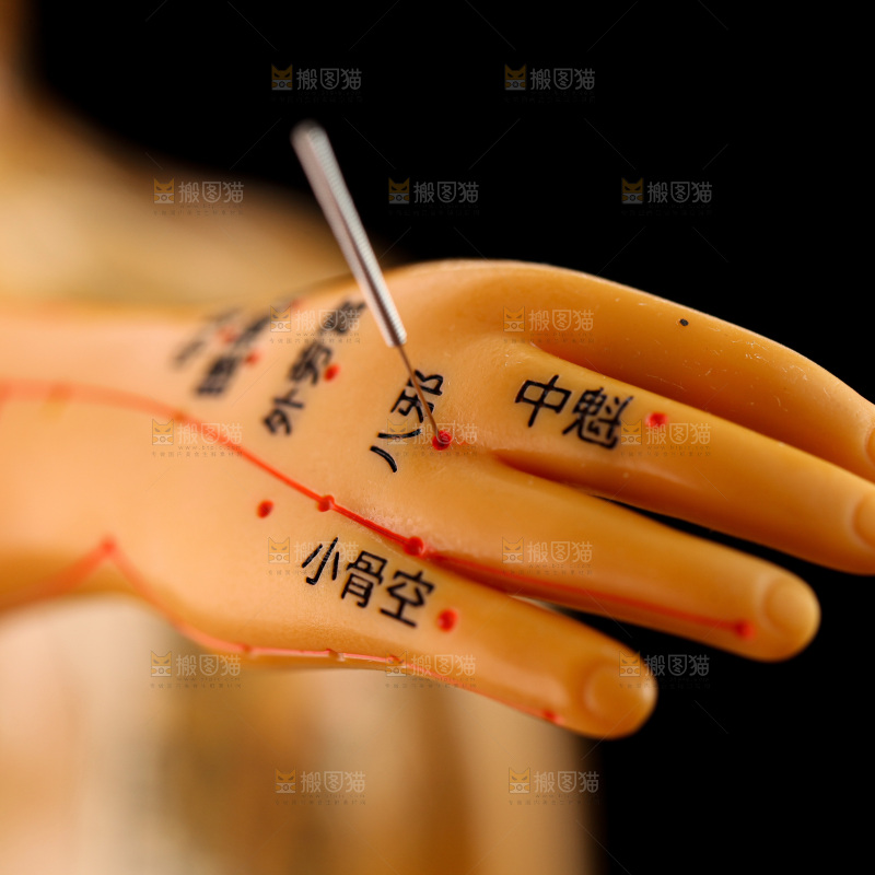 针灸