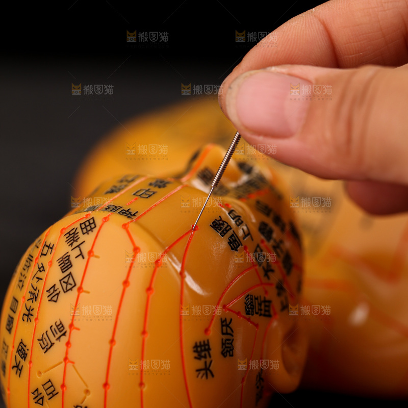 针灸