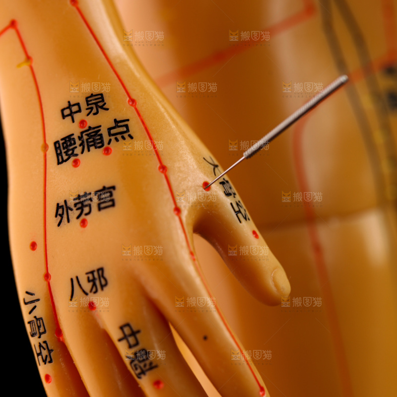 针灸