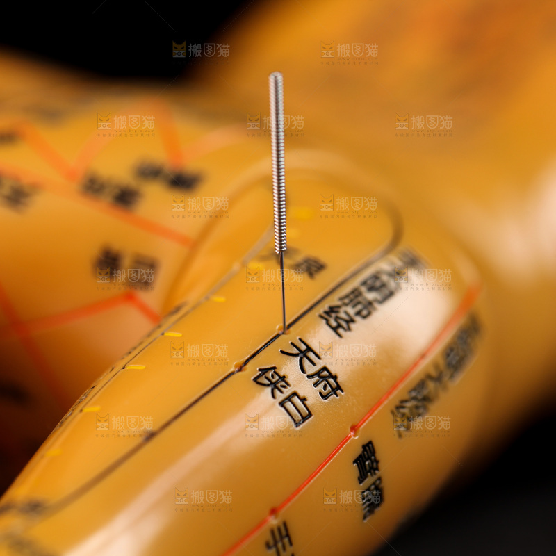 针灸