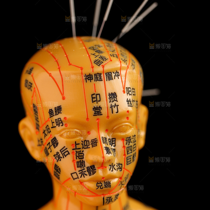 针灸