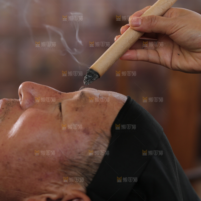 艾灸